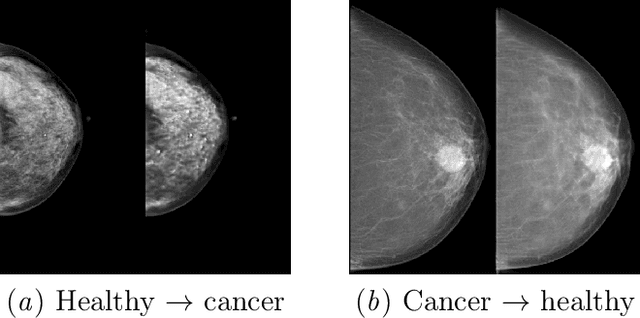 Figure 1 for Adversarial Augmentation for Enhancing Classification of Mammography Images