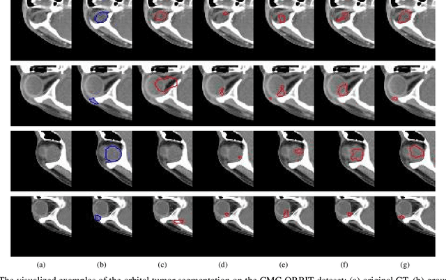 Figure 3 for Supervised Segmentation with Domain Adaptation for Small Sampled Orbital CT Images