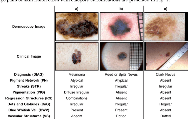Figure 1 for Graph-Based Intercategory and Intermodality Network for Multilabel Classification and Melanoma Diagnosis of Skin Lesions in Dermoscopy and Clinical Images