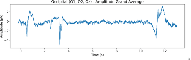 Figure 3 for Significant changes in EEG neural oscillations during different phases of three-dimensional multiple object tracking task (3D-MOT) imply different roles for attention and working memory