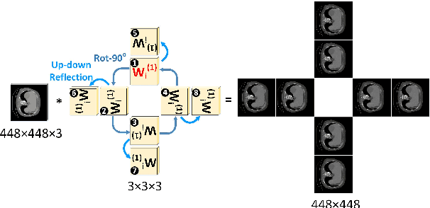Figure 3 for Beyond CNNs: Exploiting Further Inherent Symmetries in Medical Images for Segmentation