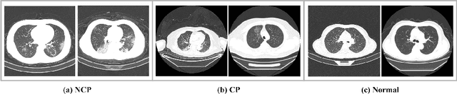 Figure 1 for DuCN: Dual-children Network for Medical Diagnosis and Similar Case Recommendation towards COVID-19