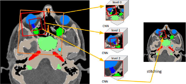 Figure 1 for Deep Neural Patchworks: Coping with Large Segmentation Tasks