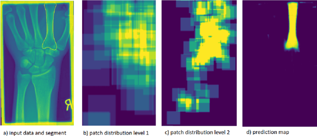 Figure 3 for Deep Neural Patchworks: Coping with Large Segmentation Tasks