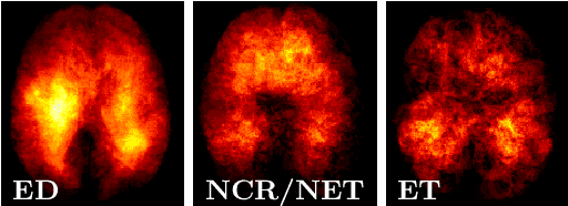 Figure 3 for Improving 3D U-Net for Brain Tumor Segmentation by Utilizing Lesion Prior