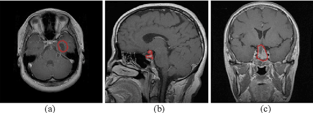 Figure 1 for Brain Tumor Classification Using Medial Residual Encoder Layers