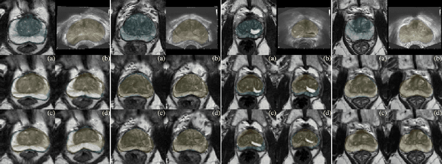 Figure 4 for Learning Multi-Modal Volumetric Prostate Registration with Weak Inter-Subject Spatial Correspondence