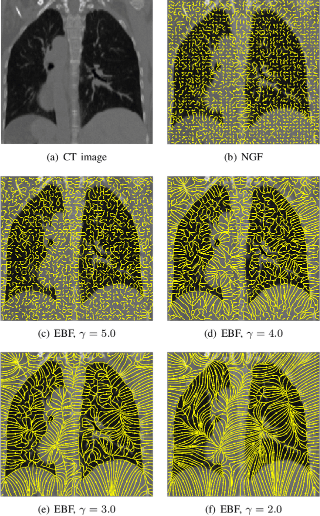 Figure 1 for Regularized directional representations for medical image registration