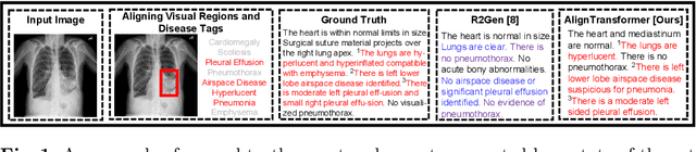 Figure 1 for AlignTransformer: Hierarchical Alignment of Visual Regions and Disease Tags for Medical Report Generation