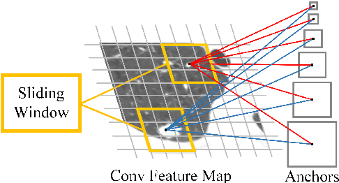 Figure 3 for Accurate Pulmonary Nodule Detection in Computed Tomography Images Using Deep Convolutional Neural Networks