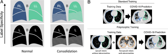 Figure 1 for CT Image Segmentation for Inflamed and Fibrotic Lungs Using a Multi-Resolution Convolutional Neural Network