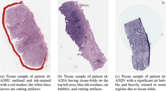 Figure 1 for CNN-based Approach for Cervical Cancer Classification in Whole-Slide Histopathology Images