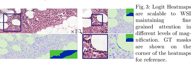 Figure 4 for Deep Learning Under the Microscope: Improving the Interpretability of Medical Imaging Neural Networks