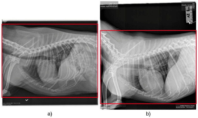 Figure 1 for Detecting Pulmonary Coccidioidomycosis (Valley fever) with Deep Convolutional Neural Networks