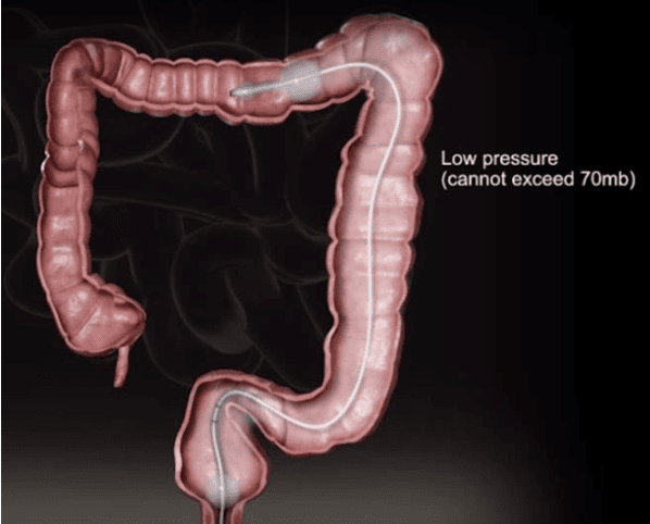 Figure 3 for Future of Flexible Robotic Endoscopy Systems