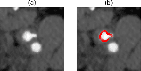 Figure 1 for Ensembling Low Precision Models for Binary Biomedical Image Segmentation