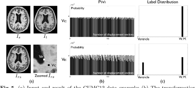 Figure 4 for On the Ambiguity of Registration Uncertainty