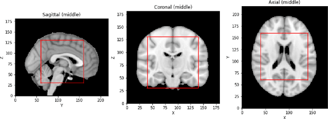 Figure 1 for Explainable Deep CNNs for MRI-Based Diagnosis of Alzheimer's Disease