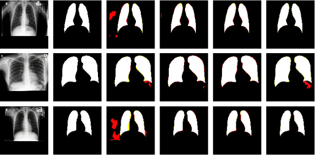 Figure 3 for MKIS-Net: A Light-Weight Multi-Kernel Network for Medical Image Segmentation