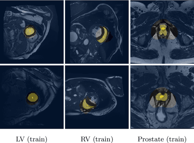 Figure 3 for Discretely-constrained deep network for weakly supervised segmentation