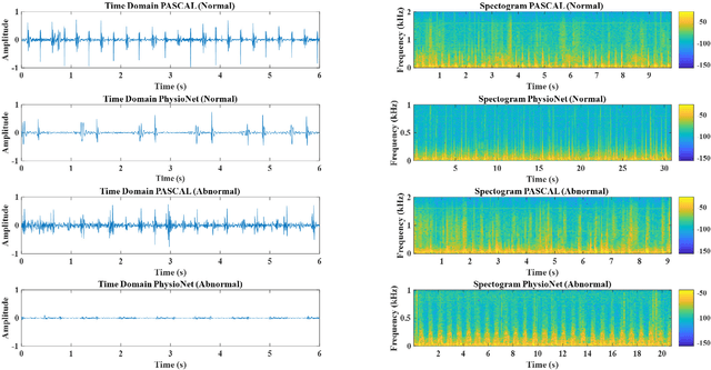 Figure 1 for Deep Learning Based Classification of Unsegmented Phonocardiogram Spectrograms Leveraging Transfer Learning