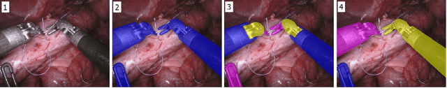 Figure 1 for Automatic Instrument Segmentation in Robot-Assisted Surgery Using Deep Learning