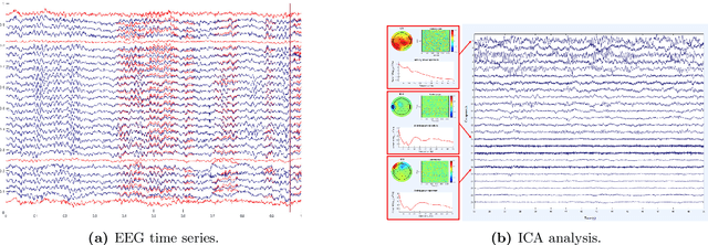 Figure 3 for Electroencephalogram (EEG) for Delineating Objective Measure of Autism Spectrum Disorder (ASD) (Extended Version)