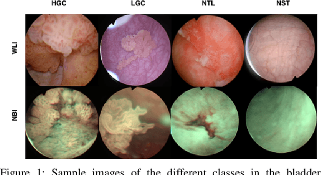 Figure 1 for Semi-supervised GAN for Bladder Tissue Classification in Multi-Domain Endoscopic Images