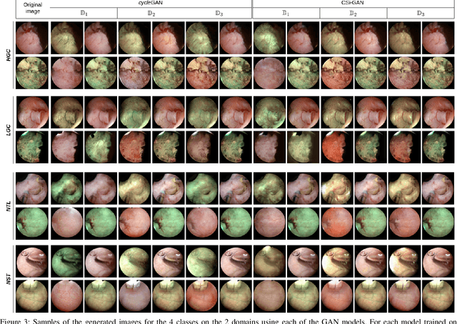 Figure 3 for Semi-supervised GAN for Bladder Tissue Classification in Multi-Domain Endoscopic Images