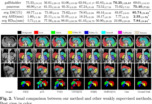 Figure 2 for Scribble-based 3D Multiple Abdominal Organ Segmentation via Triple-branch Multi-dilated Network with Pixel- and Class-wise Consistency