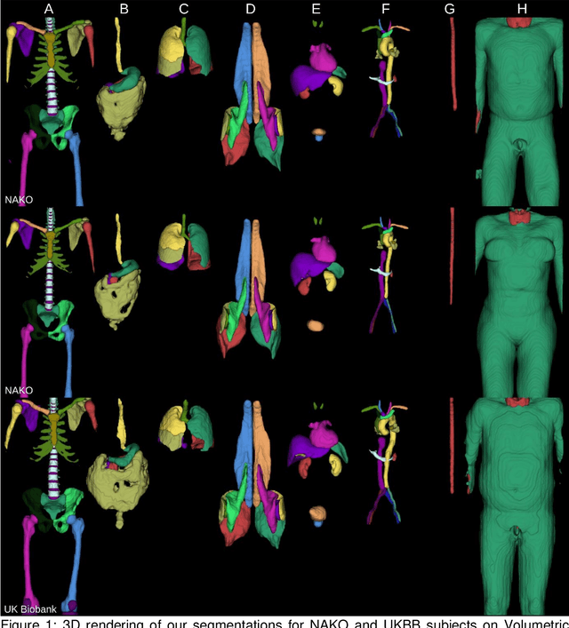 Figure 1 for TotalVibeSegmentator: Full Torso Segmentation for the NAKO and UK Biobank in Volumetric Interpolated Breath-hold Examination Body Images