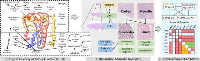 Figure 1 for PrPSeg: Universal Proposition Learning for Panoramic Renal Pathology Segmentation