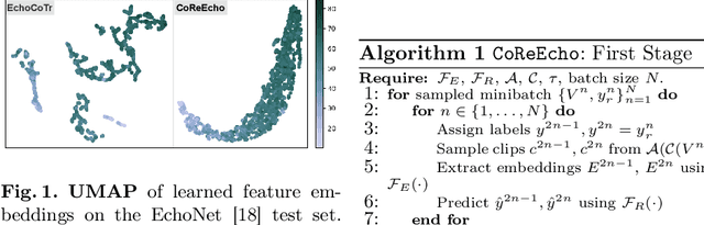 Figure 1 for CoReEcho: Continuous Representation Learning for 2D+time Echocardiography Analysis