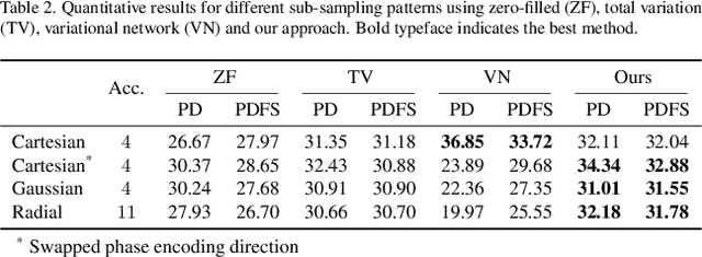 Figure 3 for Joint Non-Linear MRI Inversion with Diffusion Priors