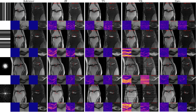 Figure 4 for Joint Non-Linear MRI Inversion with Diffusion Priors