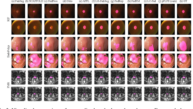 Figure 4 for pFLFE: Cross-silo Personalized Federated Learning via Feature Enhancement on Medical Image Segmentation