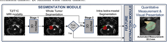 Figure 3 for A Clinical Guideline Driven Automated Linear Feature Extraction for Vestibular Schwannoma