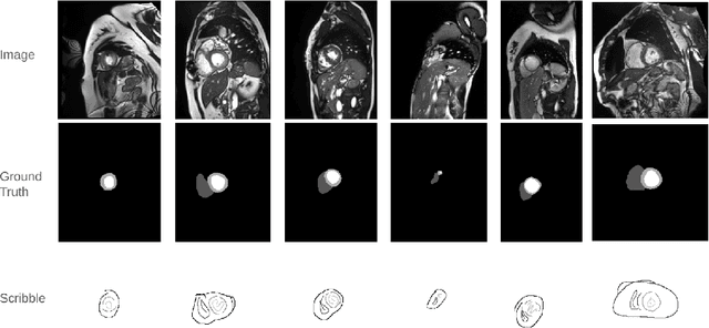 Figure 1 for Weak-Mamba-UNet: Visual Mamba Makes CNN and ViT Work Better for Scribble-based Medical Image Segmentation