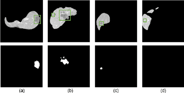 Figure 4 for Skip and Skip: Segmenting Medical Images with Prompts