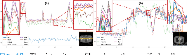 Figure 2 for Data-iterative Optimization Score Model for Stable Ultra-Sparse-View CT Reconstruction