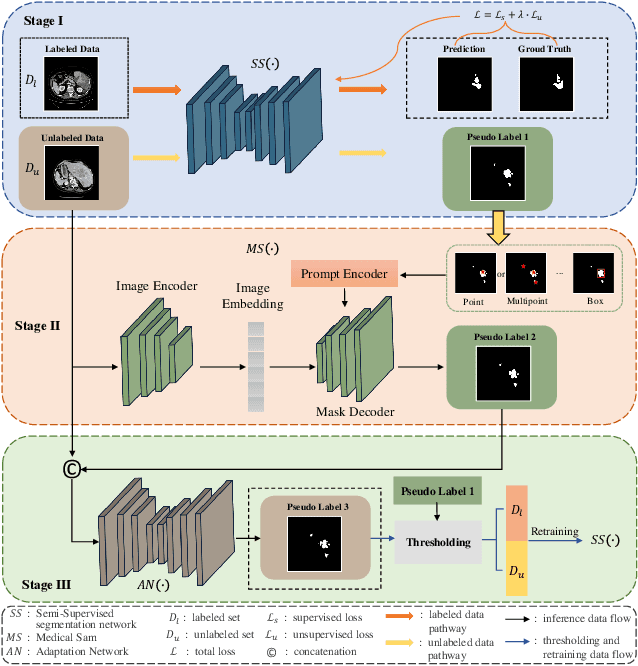 Figure 1 for ASLseg: Adapting SAM in the Loop for Semi-supervised Liver Tumor Segmentation