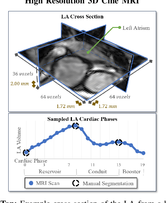 Figure 1 for High-Resolution Maps of Left Atrial Displacements and Strains Estimated with 3D CINE MRI and Unsupervised Neural Networks