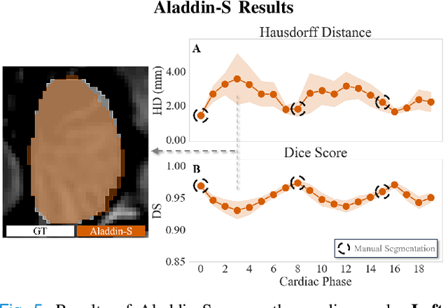 Figure 4 for High-Resolution Maps of Left Atrial Displacements and Strains Estimated with 3D CINE MRI and Unsupervised Neural Networks