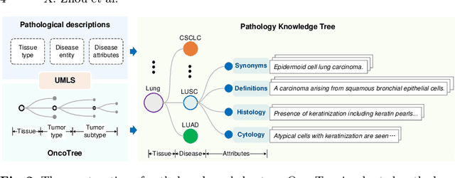 Figure 3 for Knowledge-enhanced Visual-Language Pretraining for Computational Pathology