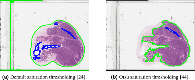 Figure 2 for Histopathology Foundation Models Enable Accurate Ovarian Cancer Subtype Classification