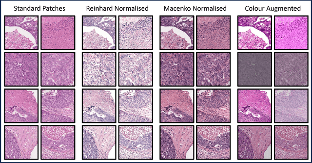 Figure 3 for Histopathology Foundation Models Enable Accurate Ovarian Cancer Subtype Classification