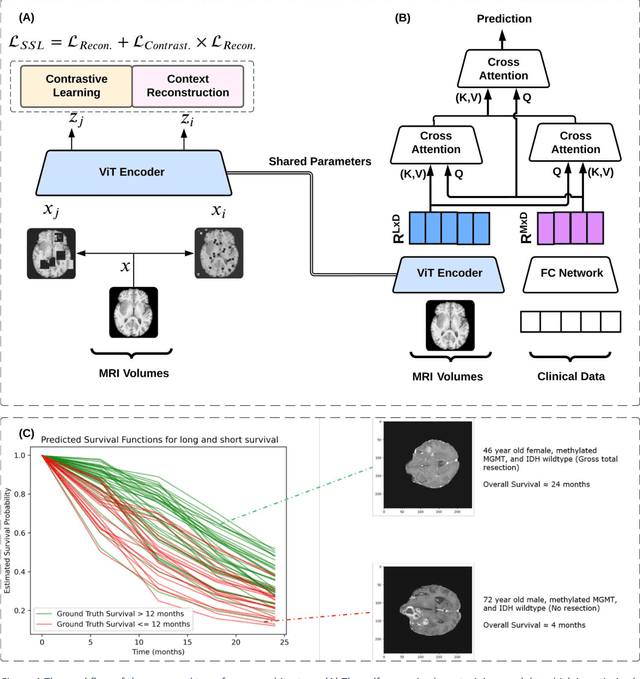 Figure 1 for Comprehensive Multimodal Deep Learning Survival Prediction Enabled by a Transformer Architecture: A Multicenter Study in Glioblastoma