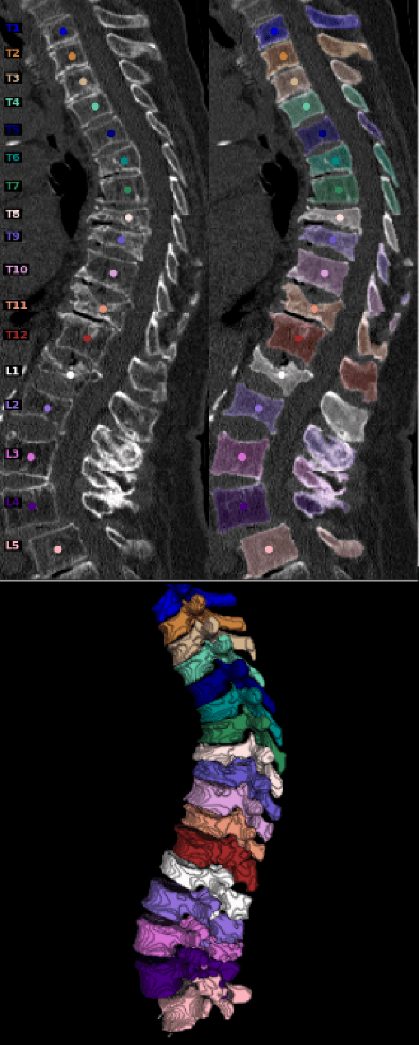 Figure 3 for Panoptica -- instance-wise evaluation of 3D semantic and instance segmentation maps