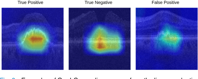 Figure 3 for 3DTINC: Time-Equivariant Non-Contrastive Learning for Predicting Disease Progression from Longitudinal OCTs