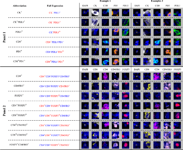 Figure 3 for An AI based Digital Score of Tumour-Immune Microenvironment Predicts Benefit to Maintenance Immunotherapy in Advanced Oesophagogastric Adenocarcinoma